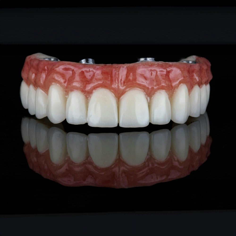 all-on-4-implants-denture_1755870683 all-on-4-implants-denture_1755870683